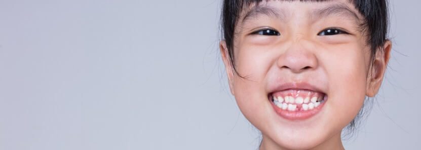 When Do Kids Start Losing Teeth?